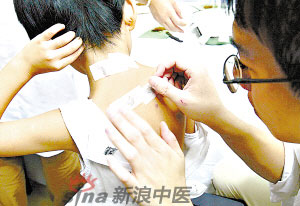 灸法的種類  你知道多少？